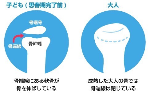 身長が伸びる仕組み 骨端線 成長期が過ぎても身長を伸ばす方法